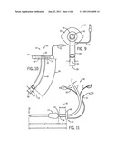 SUPRAGLOTTIC FIXATION DEVICE FOR ENDOTRACHEAL TUBES diagram and image