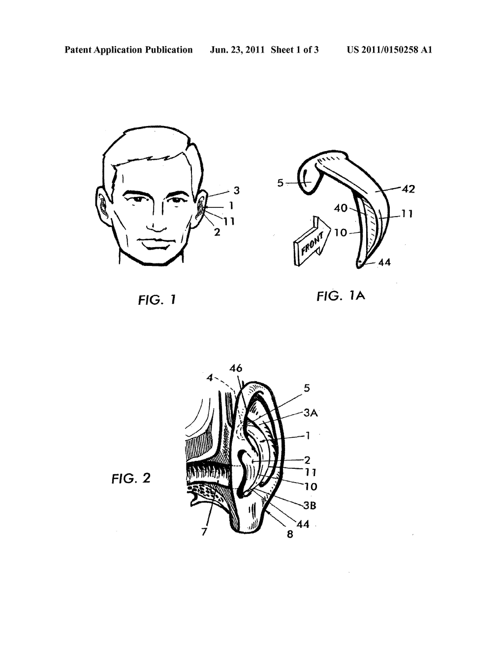 EXTERNAL EAR INSERT FOR HEARING COMPREHENSION ENHANCEMENT - diagram, schematic, and image 02