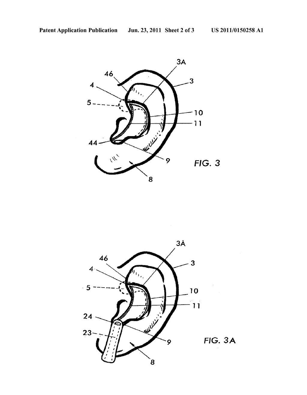 EXTERNAL EAR INSERT FOR HEARING COMPREHENSION ENHANCEMENT - diagram, schematic, and image 03