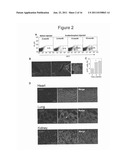 METHOD FOR THE THERAPEUTIC CORRECTION OF HEMOPHILIA A BY     TRANSPLANTING BONE MARROW CELLS diagram and image