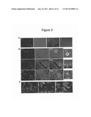 METHOD FOR THE THERAPEUTIC CORRECTION OF HEMOPHILIA A BY     TRANSPLANTING BONE MARROW CELLS diagram and image