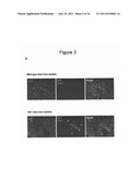 METHOD FOR THE THERAPEUTIC CORRECTION OF HEMOPHILIA A BY     TRANSPLANTING BONE MARROW CELLS diagram and image