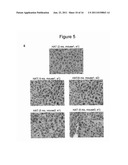 METHOD FOR THE THERAPEUTIC CORRECTION OF HEMOPHILIA A BY     TRANSPLANTING BONE MARROW CELLS diagram and image