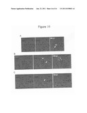 METHOD FOR THE THERAPEUTIC CORRECTION OF HEMOPHILIA A BY     TRANSPLANTING BONE MARROW CELLS diagram and image