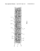 REINFORCEMENT TEXTILE ARMATURE AND METHOD FOR MAKING SAME diagram and image
