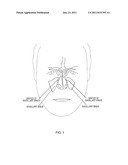 DEVICE AND METHOD FOR DELIVERING THERAPEUTIC SUBSTANCES TO THE MAXILLARY     SINUS OF A PATIENT diagram and image