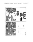 USE OF METHYLATED OR UNMETHYLATED LINE-1 DNA AS A CANCER MARKER diagram and image