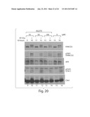 Compositions And Methods For The Treatment Of Cancer diagram and image