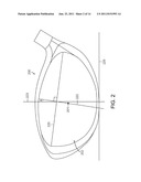 GOLF CLUB HEAD WITH IMPROVED PERFORMANCE diagram and image