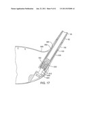 GOLF CLUB diagram and image