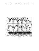 EEG MONITOR OF FETAL HEALTH diagram and image