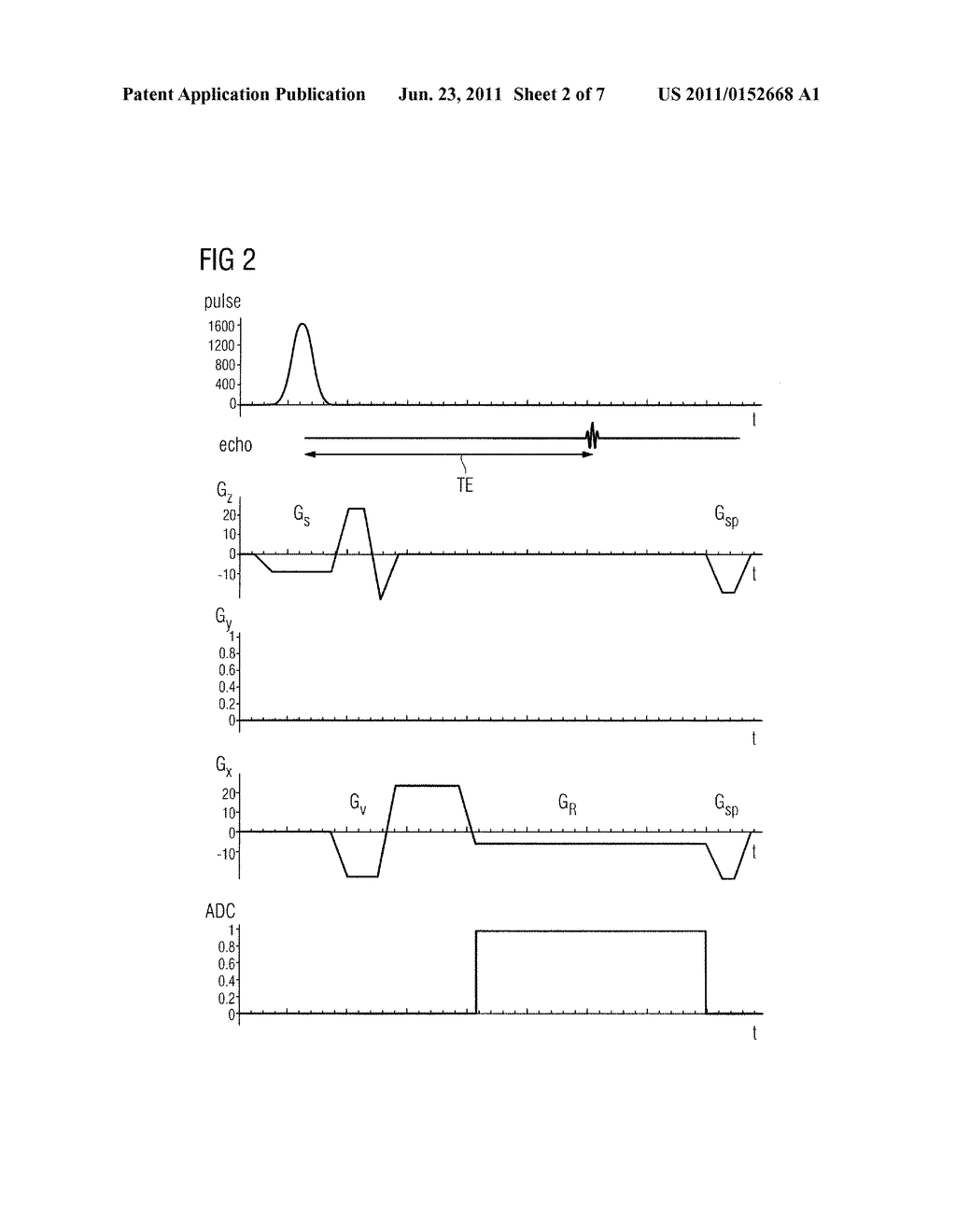 METHOD TO DETECT A BREATHING MOVEMENT OF AN EXAMINATION SUBJECT     CORRESPONDING TO SIGNAL DATA BY MAGNETIC RESONANCE - diagram, schematic, and image 03