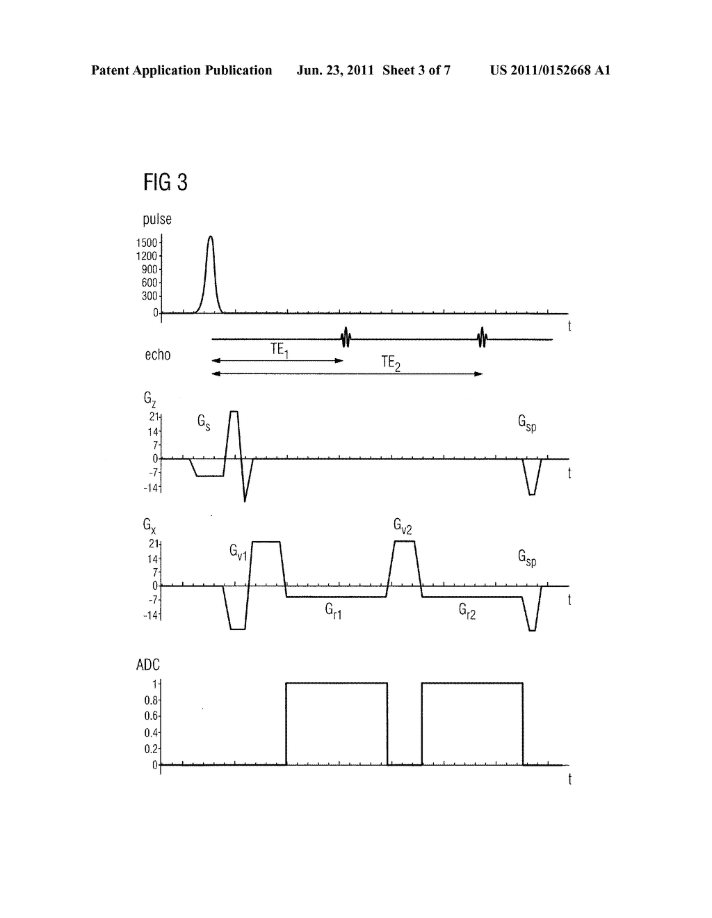 METHOD TO DETECT A BREATHING MOVEMENT OF AN EXAMINATION SUBJECT     CORRESPONDING TO SIGNAL DATA BY MAGNETIC RESONANCE - diagram, schematic, and image 04
