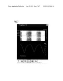 METHOD TO DETECT A BREATHING MOVEMENT OF AN EXAMINATION SUBJECT     CORRESPONDING TO SIGNAL DATA BY MAGNETIC RESONANCE diagram and image