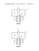Illuminating Balloon Catheter and Method for Using the Catheter diagram and image