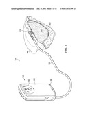 REDUCED-PRESSURE, MULTI-ORIENTATION, LIQUID-COLLECTION CANISTER diagram and image