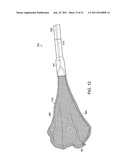 SURGICAL INSTRUMENT COMPRISING AN ELECTRODE diagram and image