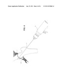 METHOD, DEVICE, AND SYSTEM FOR SHAVING AND SHAPING OF A JOINT diagram and image