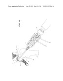 METHOD, DEVICE, AND SYSTEM FOR SHAVING AND SHAPING OF A JOINT diagram and image