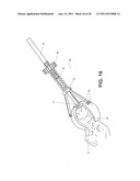 METHOD, DEVICE, AND SYSTEM FOR SHAVING AND SHAPING OF A JOINT diagram and image