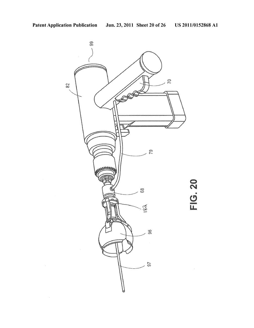 METHOD, DEVICE, AND SYSTEM FOR SHAVING AND SHAPING OF A JOINT - diagram, schematic, and image 21