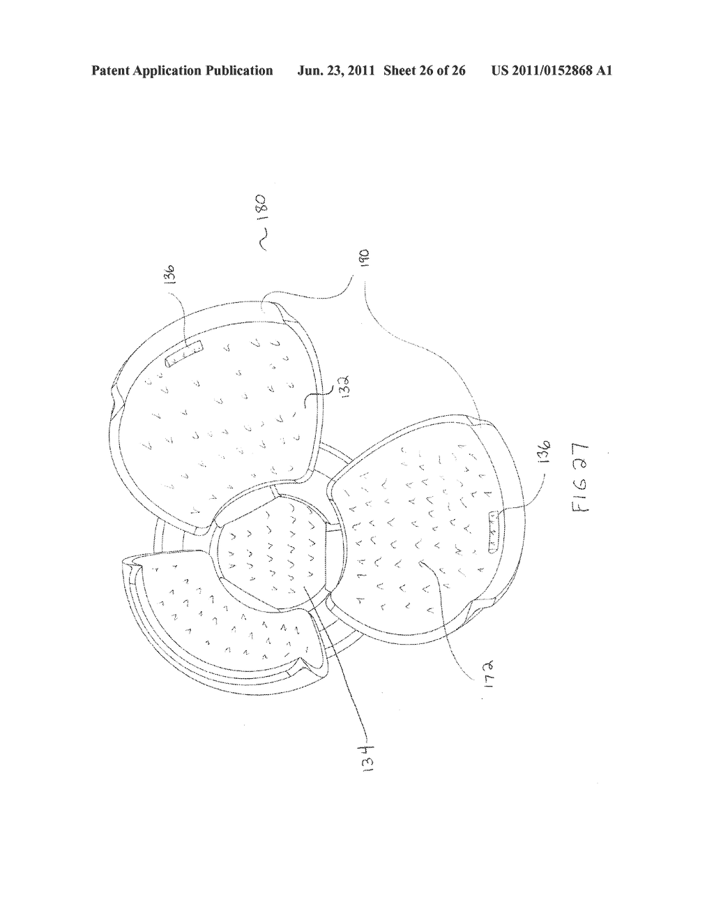 METHOD, DEVICE, AND SYSTEM FOR SHAVING AND SHAPING OF A JOINT - diagram, schematic, and image 27