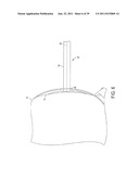 Bone Resurfacing System and Method diagram and image