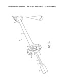 Bone Resurfacing System and Method diagram and image