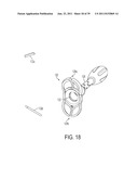 Bone Resurfacing System and Method diagram and image