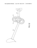 Bone Resurfacing System and Method diagram and image