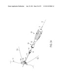 Bone Resurfacing System and Method diagram and image