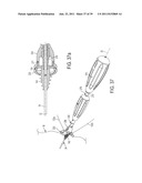 Bone Resurfacing System and Method diagram and image