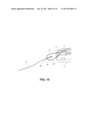 SUTURE PASSING INSTRUMENT AND METHOD diagram and image