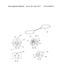 SUTURE PASSING INSTRUMENT AND METHOD diagram and image