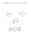 SUTURE PASSING INSTRUMENT AND METHOD diagram and image