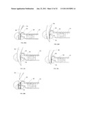 SUTURE PASSING INSTRUMENT AND METHOD diagram and image