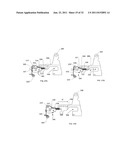 SUTURE PASSING INSTRUMENT AND METHOD diagram and image