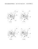 SUTURE PASSING INSTRUMENT AND METHOD diagram and image