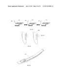 SUTURE PASSING INSTRUMENT AND METHOD diagram and image