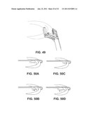 SUTURE PASSING INSTRUMENT AND METHOD diagram and image