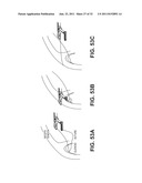 SUTURE PASSING INSTRUMENT AND METHOD diagram and image