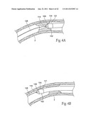 Devices, systems, and methods for performing atherectomy including     delivery of a bioactive material diagram and image