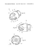 Devices, systems, and methods for performing atherectomy including     delivery of a bioactive material diagram and image