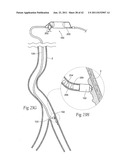 Devices, systems, and methods for performing atherectomy including     delivery of a bioactive material diagram and image