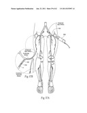 Devices, systems, and methods for performing atherectomy including     delivery of a bioactive material diagram and image