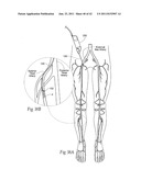 Devices, systems, and methods for performing atherectomy including     delivery of a bioactive material diagram and image