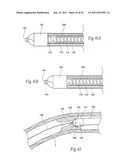 Devices, systems, and methods for performing atherectomy including     delivery of a bioactive material diagram and image