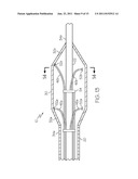 Catheter Having Internal Mechanisms to Encourage Balloon Re-folding diagram and image