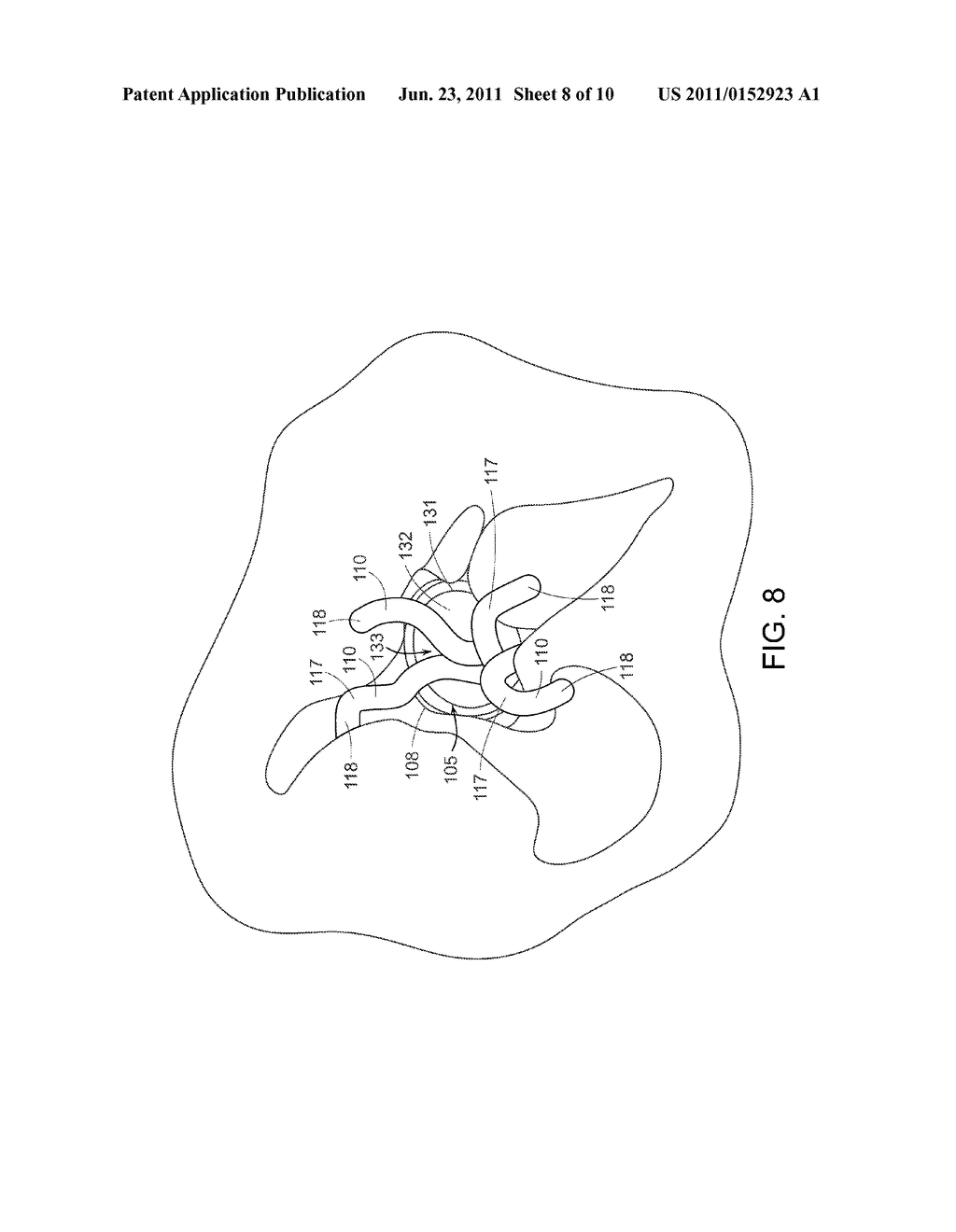 INCISION CLOSURE DEVICE - diagram, schematic, and image 09