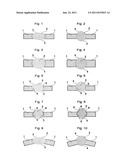 ACCOMMODATING INTRAOCULAR LENS diagram and image